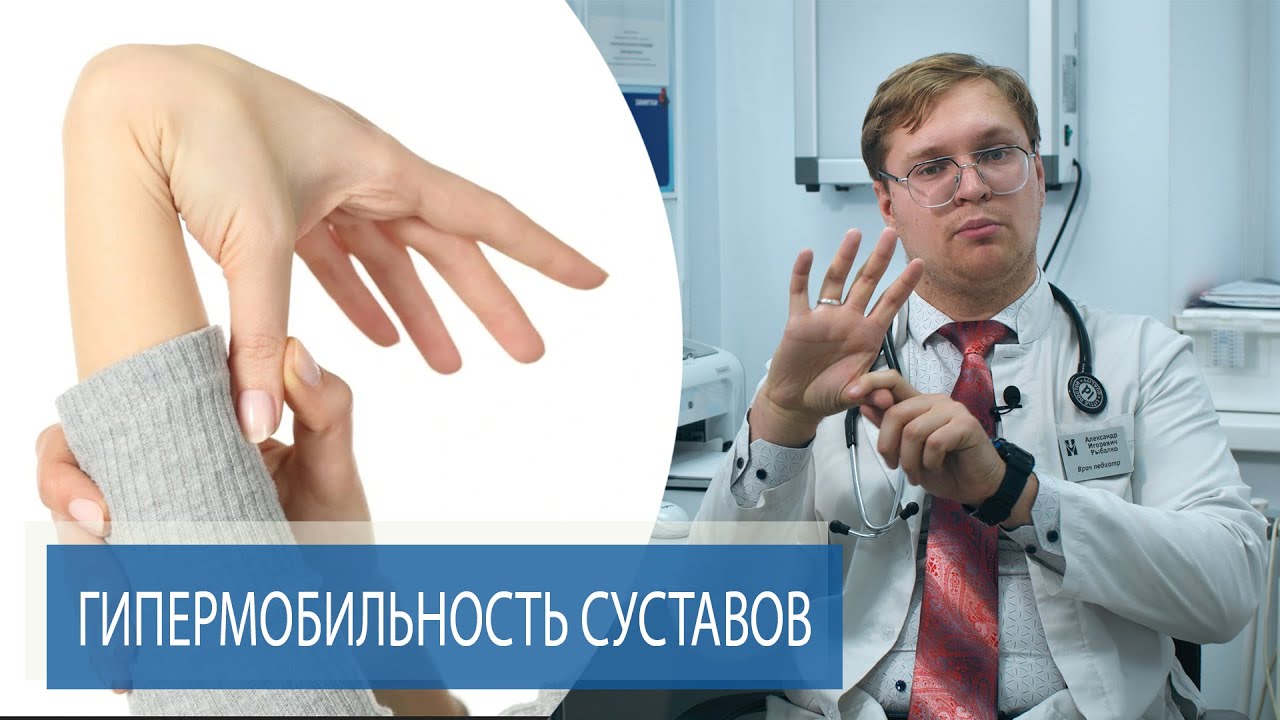 ГИПЕРМОБИЛЬНОСТЬ СУСТАВОВ | Дисплазия соединительной ткани