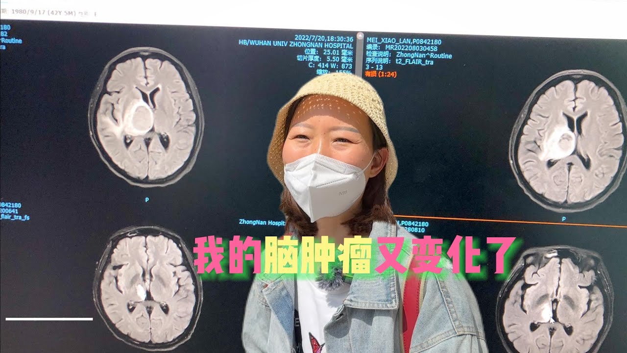 我的脑部核磁共振结果出来了，公公也可能要住院了……