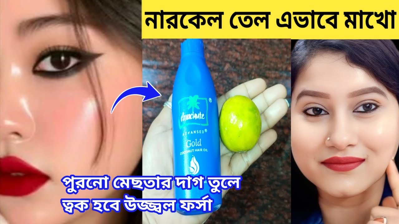 রাতে  নারকেলতেল এভাবে লাগাও পুরনো মেছতার দাগ তুলে ত্বক ধবধবে ফর্সা উজ্জ্বল হবে/forsa howar tips 