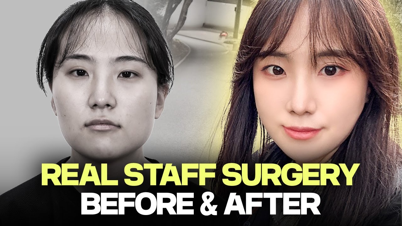 [SUB] I work at a Clinic, and this is my Final Result!