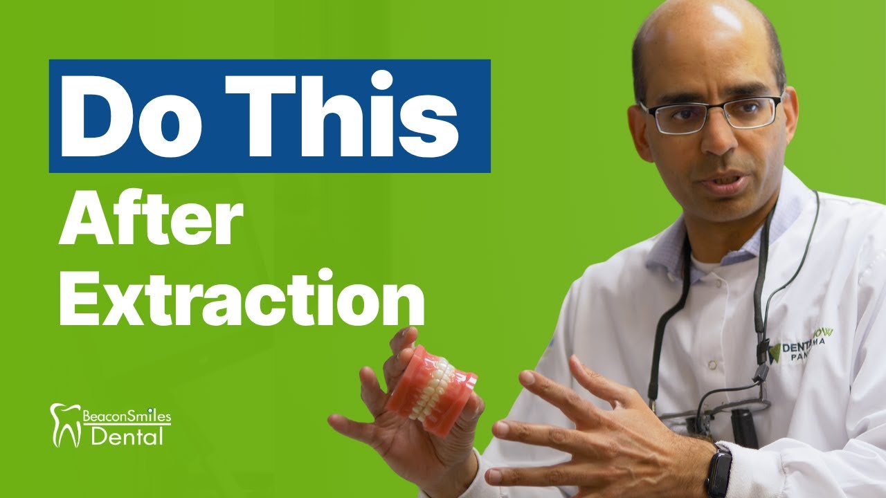 Don’t Ignore This Step After a Tooth Extraction