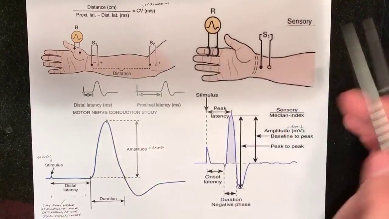 Nerve Conduction Studies (NCV) Fundamentals
