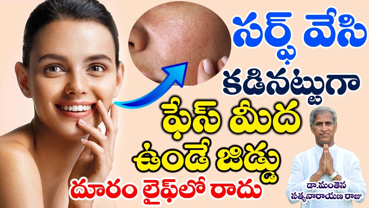 Oily Skin Care | సర్ఫ్ వేసి కడినట్లుగా పేస్ మీద ఉండే జిడ్డు దూరం | Dr Manthena Satyanarayana Raju