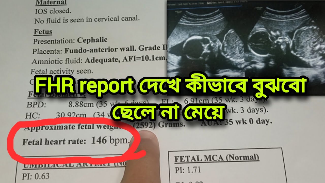 FHR report দেখে কীভাবে বুঝবো ছেলে না মেয়ে❓💁‍♀️