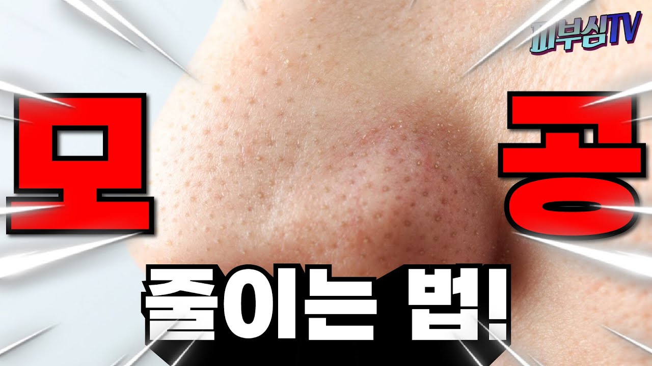 돈 안들이고 모공 줄이는 법! [피부과전문의 피부심]