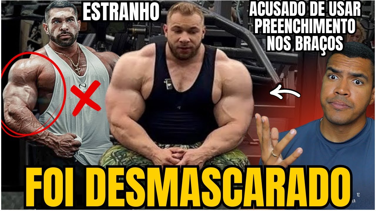 ELE NÃO PARA DE CRESCER E SURGEM ACUSAÇÕES DE USO DE PMMA NOS BRAÇOS, PEITO E ABS