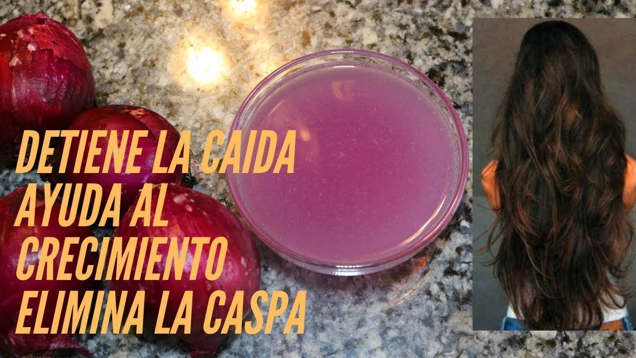 AGUA DE CEBOLLA PARA EL CRECIMIENTO DEL CABELLO || Las Recetas de Mama