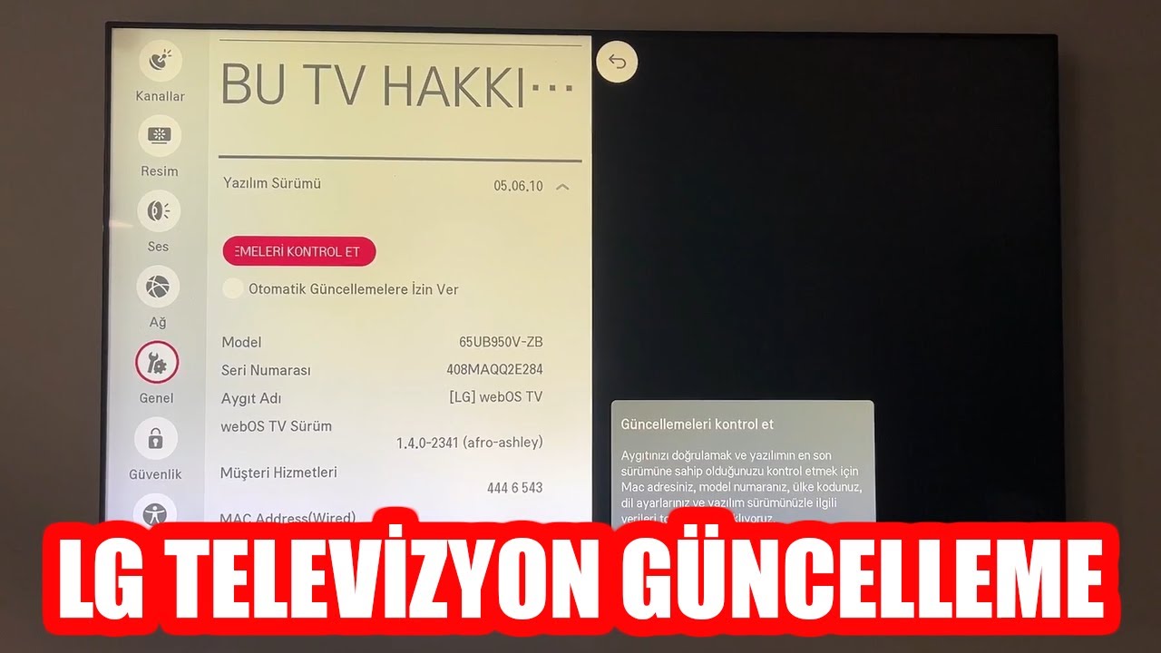 LG TELEVİZYON G&Uuml;NCELLEME (2025)