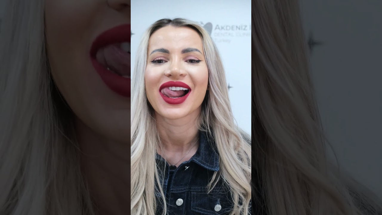ANDREA'S SMILE MAKEOVER