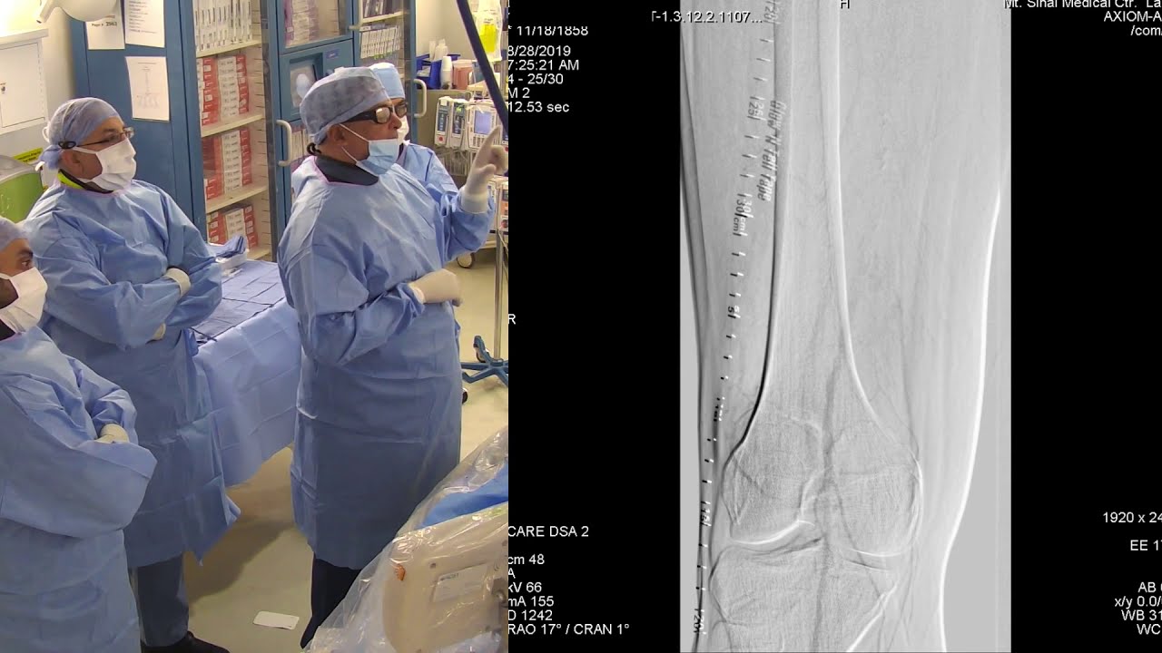 Peripheral intervention live webcast - August 2019