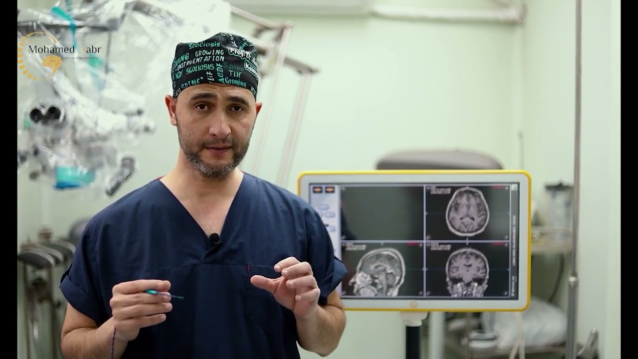متلازمة الحبل الشوكي المربوط (Tethered Cord Syndrome) أ.د محمد جبر استاذ جراحة مخ واعصاب