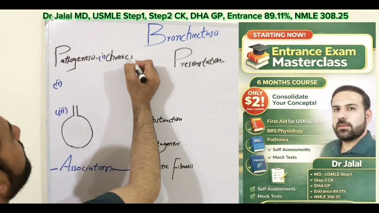 Bronchiectasis