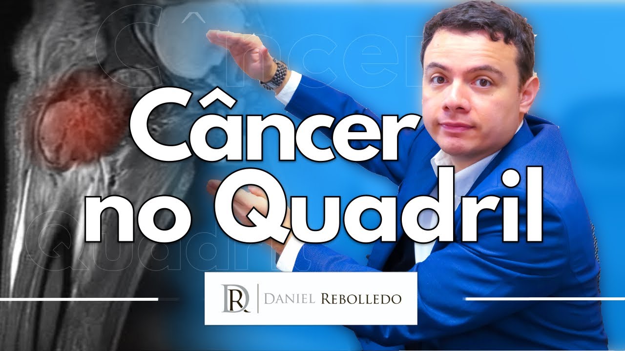 Câncer no Quadril.