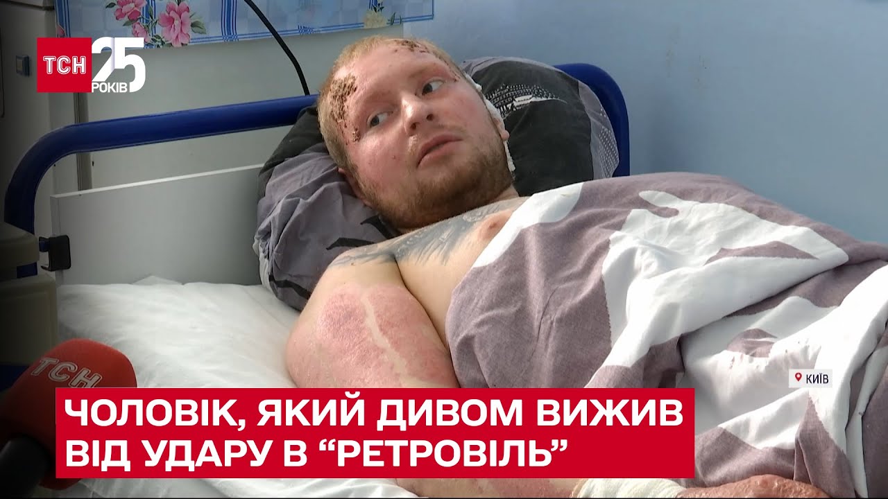 💔 Чудом выжил после ракетного удара по 