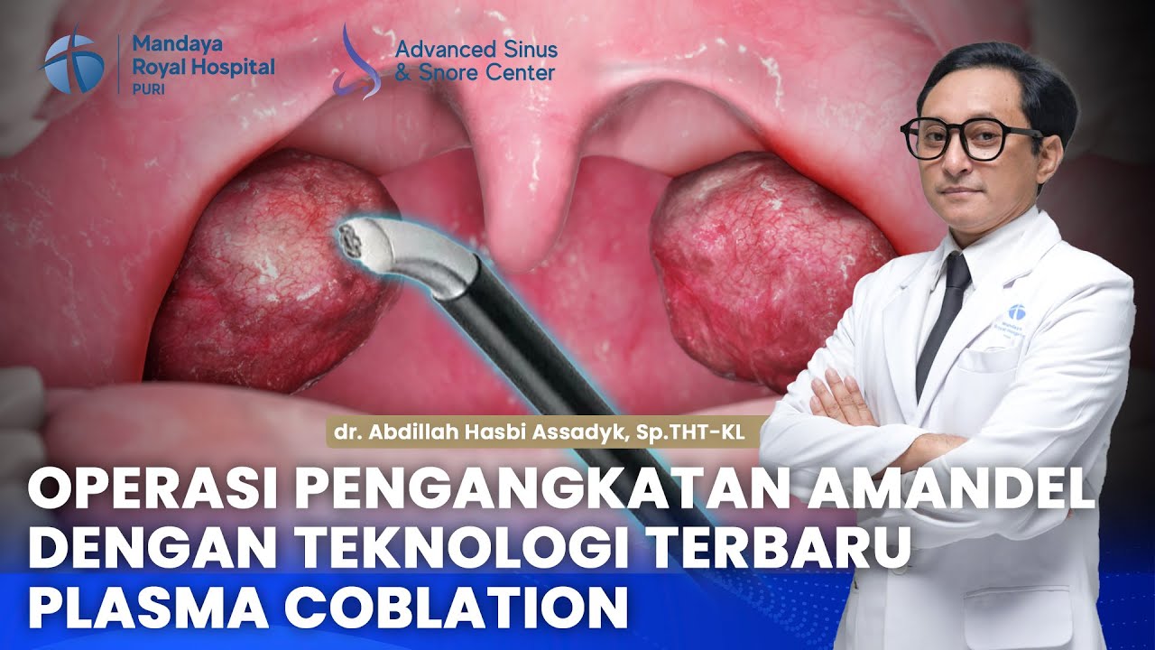 Operasi Radang Amandel Teknologi Terbaru Tanpa Luka dan Minim Nyeri | Pusat Sinus & THT Mandaya