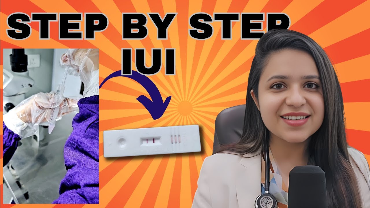 IUI process step by step | IUI treatment for pregnancy
