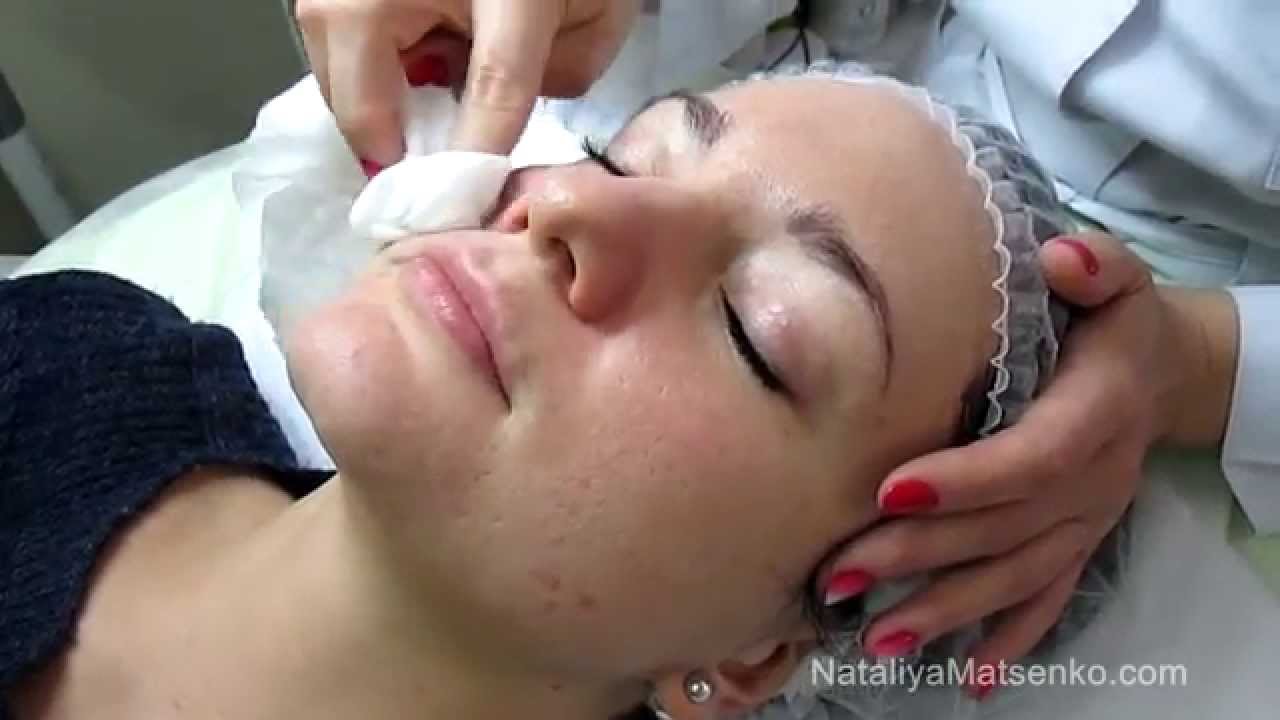 Дермапен (Dermapen) Часть 1