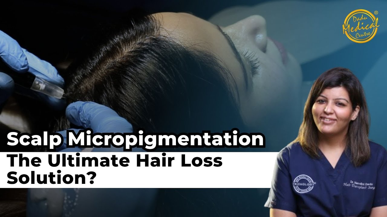 Scalp Micropigmentation: The Ultimate Hair Loss Solution? | Dr Nandini Dadu