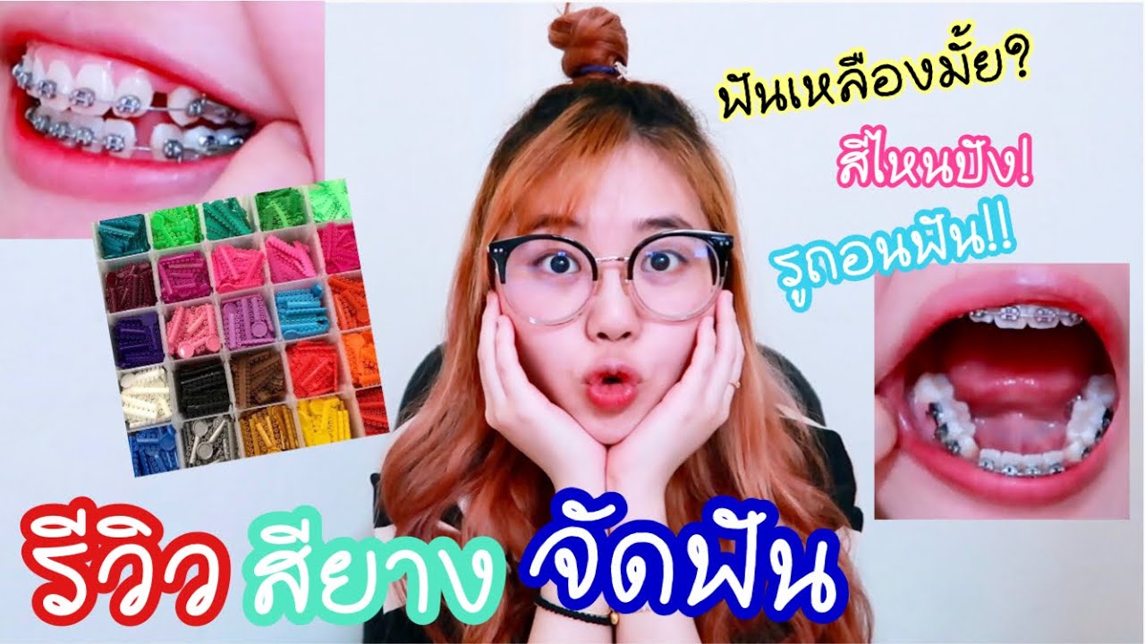 รีวิวสียางจัดฟันEP.16สียางอันไหนรอด..+ไม่รอด+อัปเดตเดือน6🥶❤️