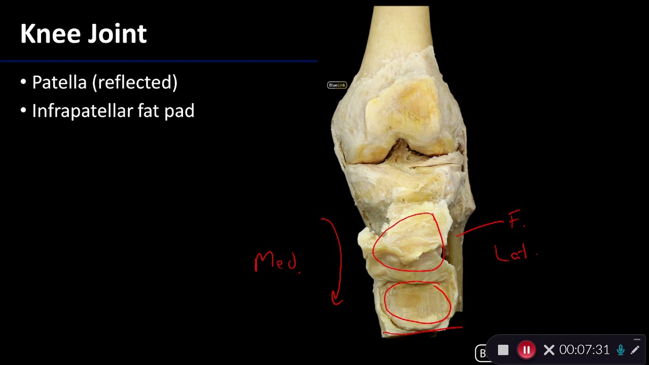 Knee Joint - Dissection Supplement