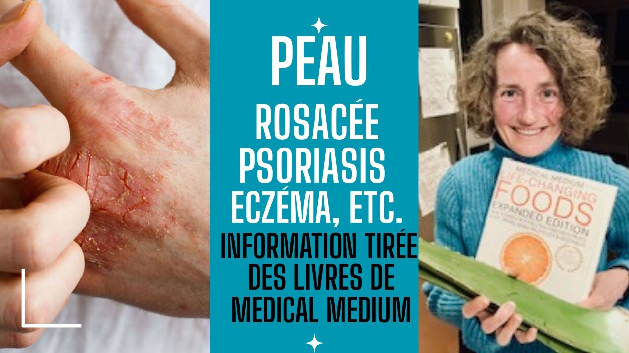 Peau: eczéma, psoriasis, rosacée et autres problèmes.  Truc SIMPLE qui aide la peau ET la digestion