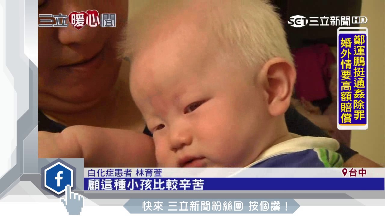 不畏異樣眼光　白化夫妻生下兩子勇敢做自己│三立新聞台