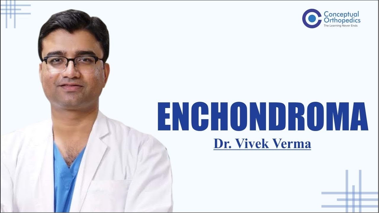 Enchondroma By Dr. Vivek Verma @ConceptualOrthopedics