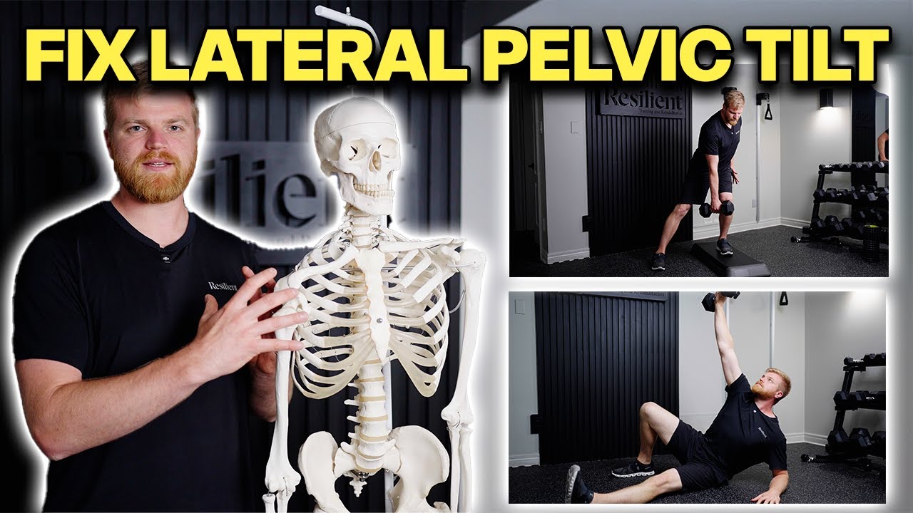 How to Correct Lateral Pelvic Tilt  (Exercises That Actually Work)