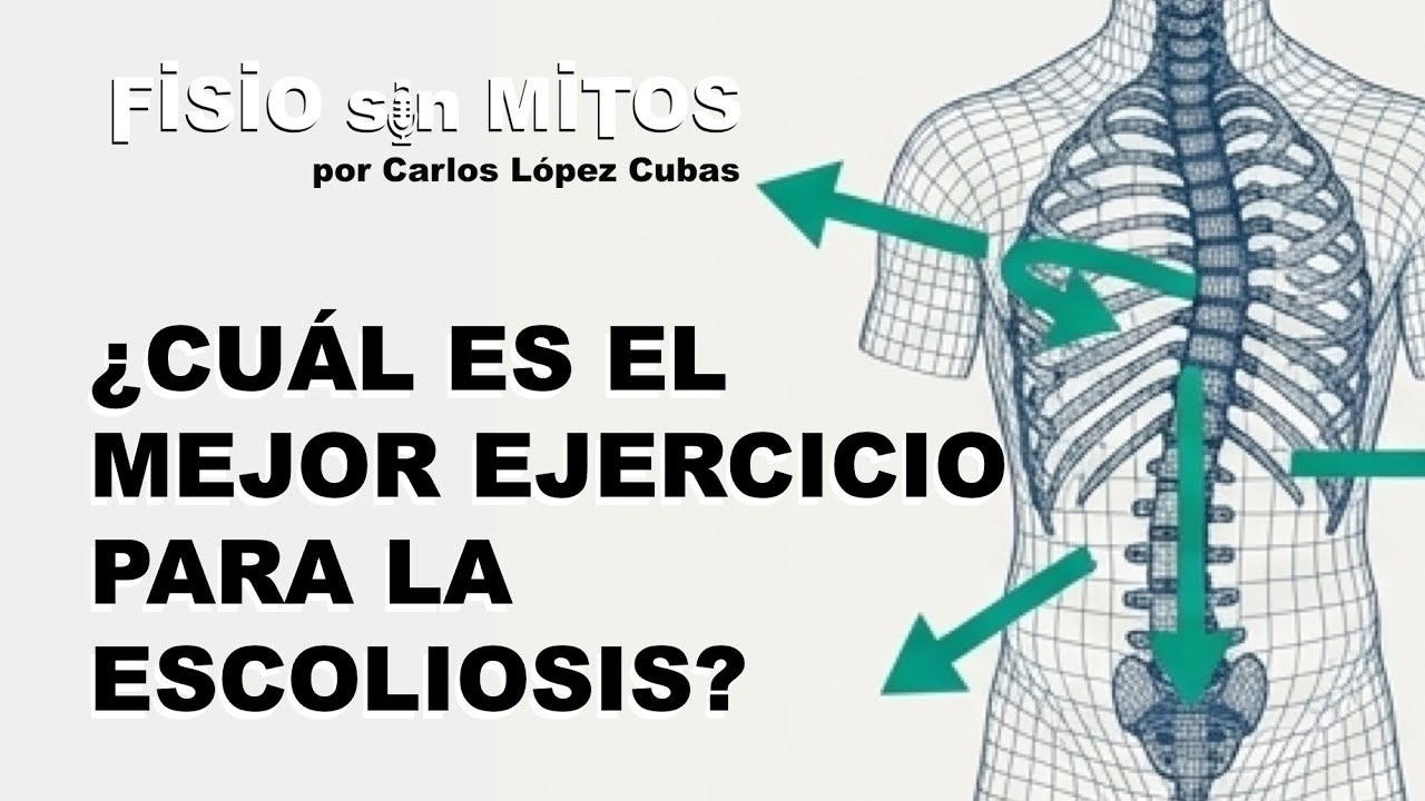 ¿Cuál es el mejor ejercicio para la escoliosis? | Fisio sin Mitos | 3x03