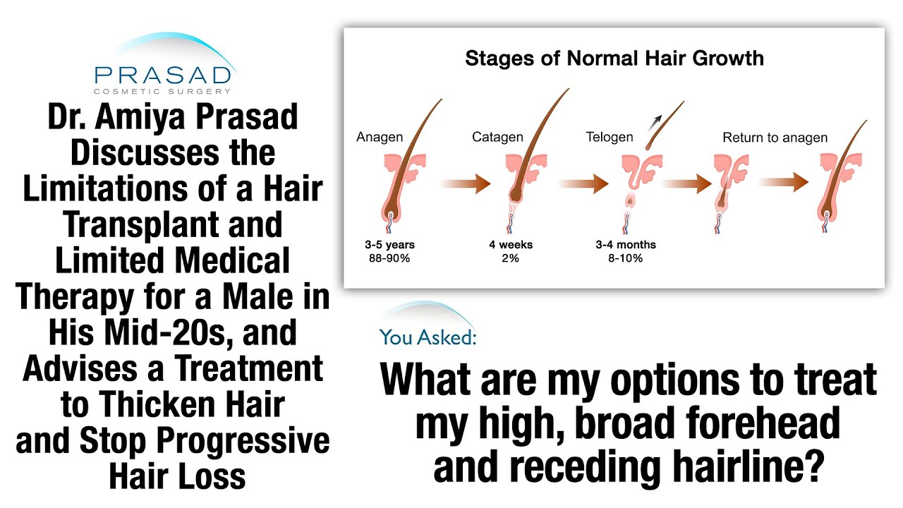 Why a Hair Transplant Won't Stop Male Pattern Baldness, and a Non-Surgical Hair Loss Treatment