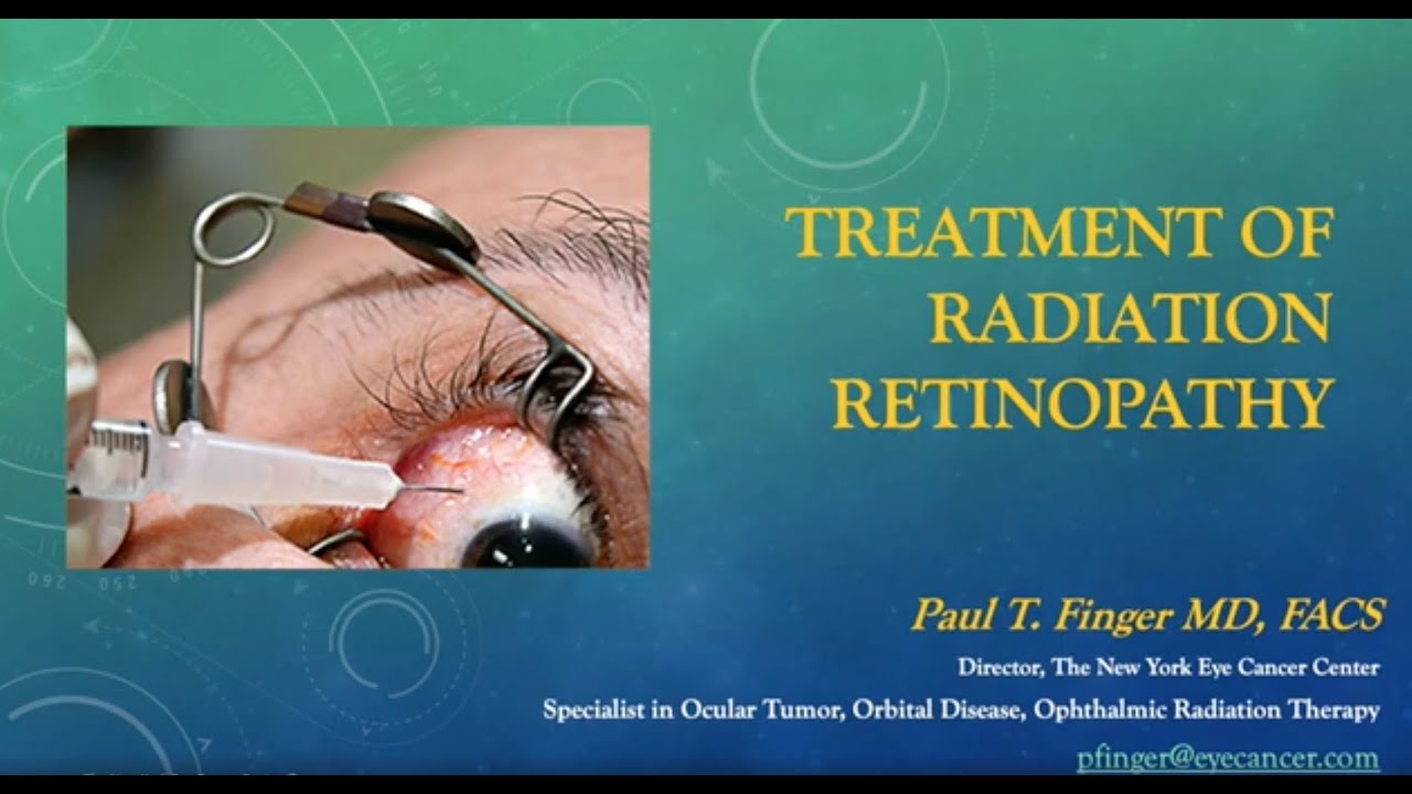 Eye Cancer: Dr. Finger on Radiation Retinopathy Treatment 2020