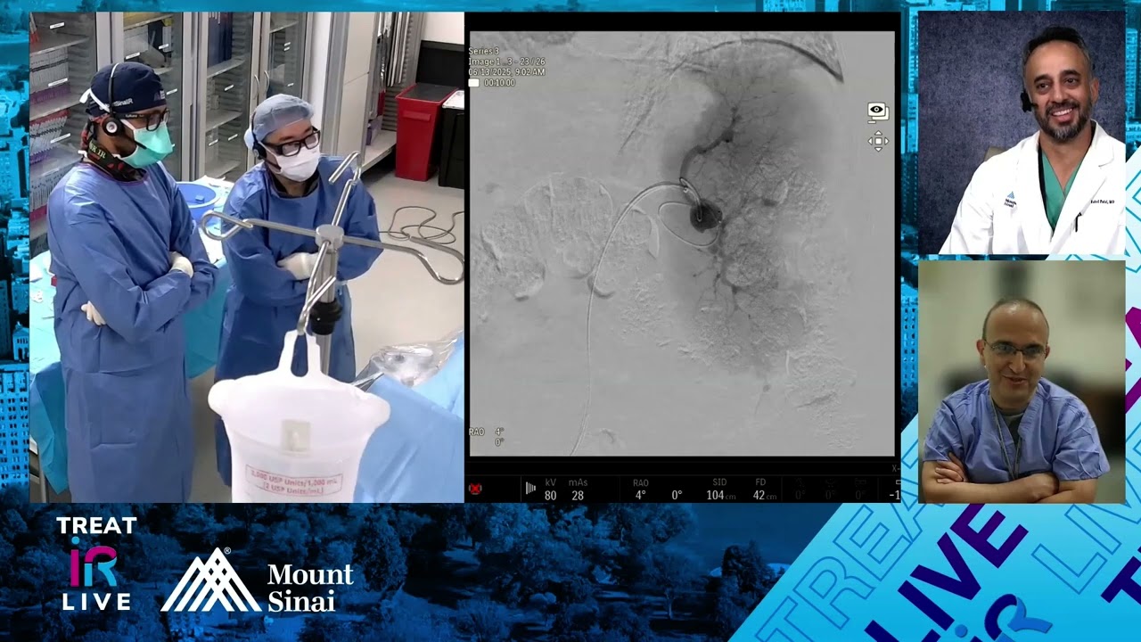 Transfemoral Coil Embolization of a Splenic Artery Aneurysm