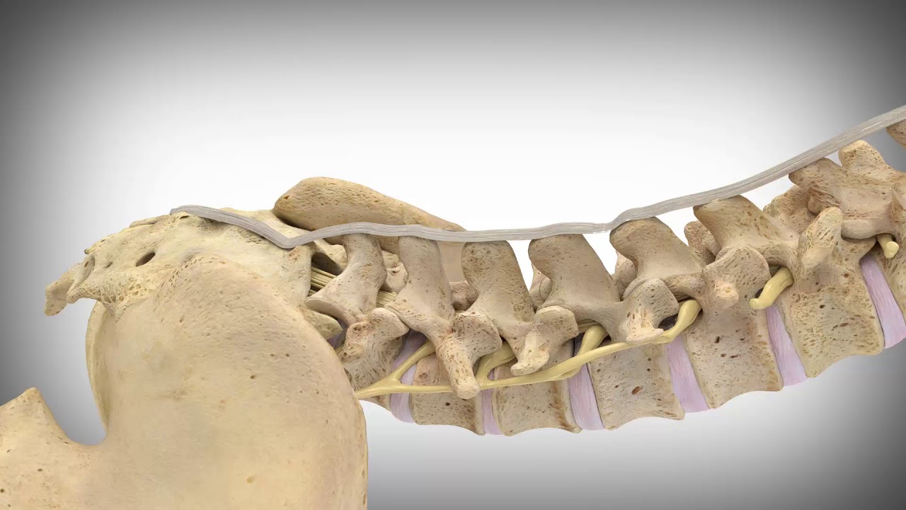 Vertiflex Superion Patient Animation