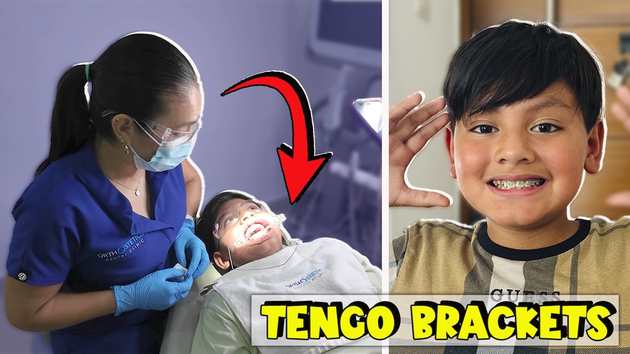 LE PUSIERON BRACKETS A KARIM | Family Juega