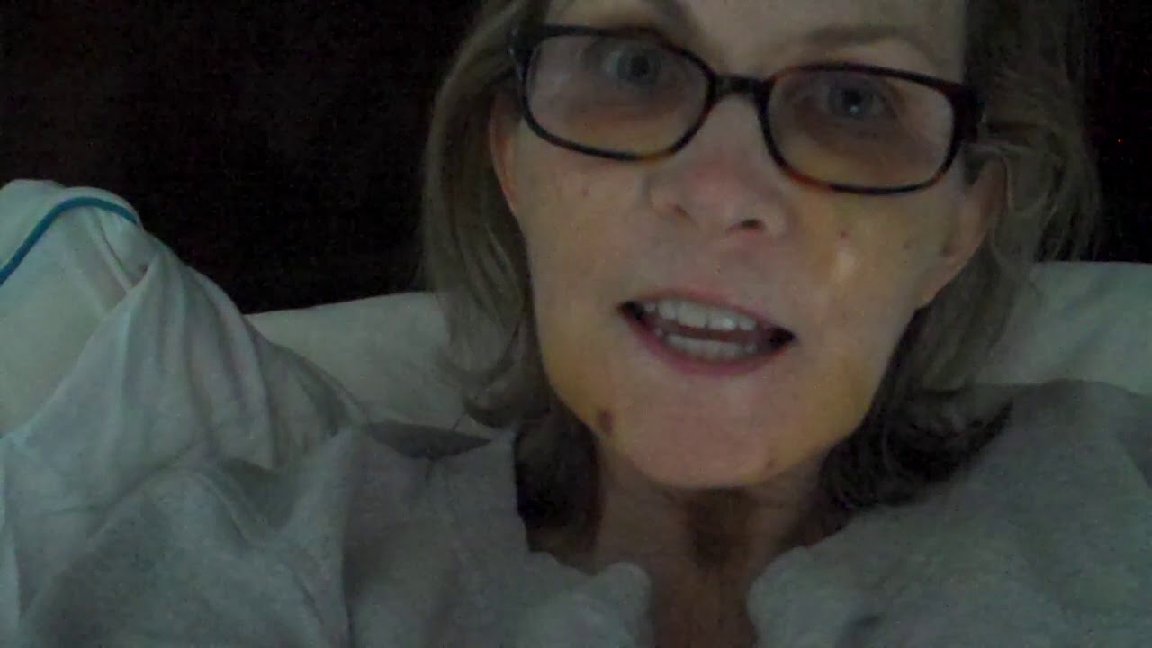 Fat Grafting/Fat Transfer Recovery Video 1 Week Results in Dallas, Texas