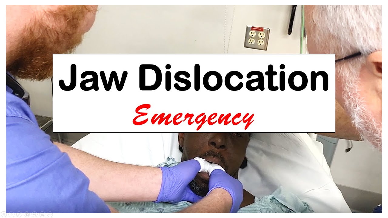 Acute Jaw Dislocation Emergency