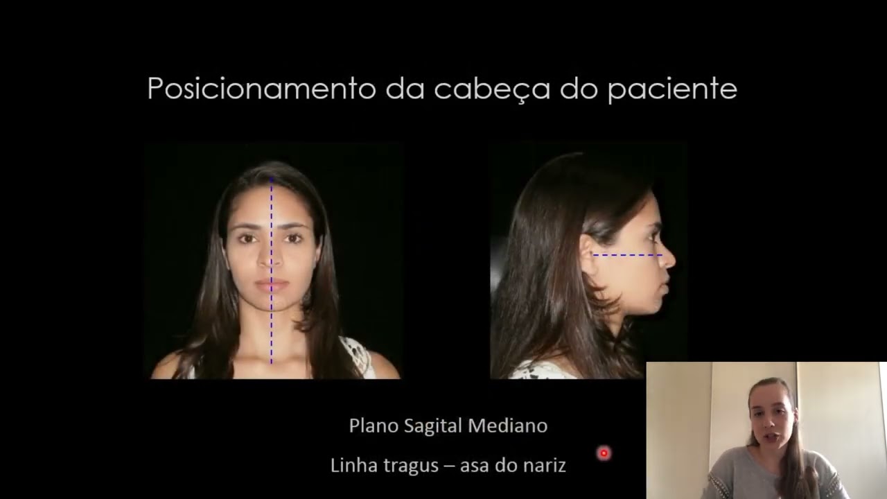 Aula | Técnicas radiográficas interproximal e oclusal