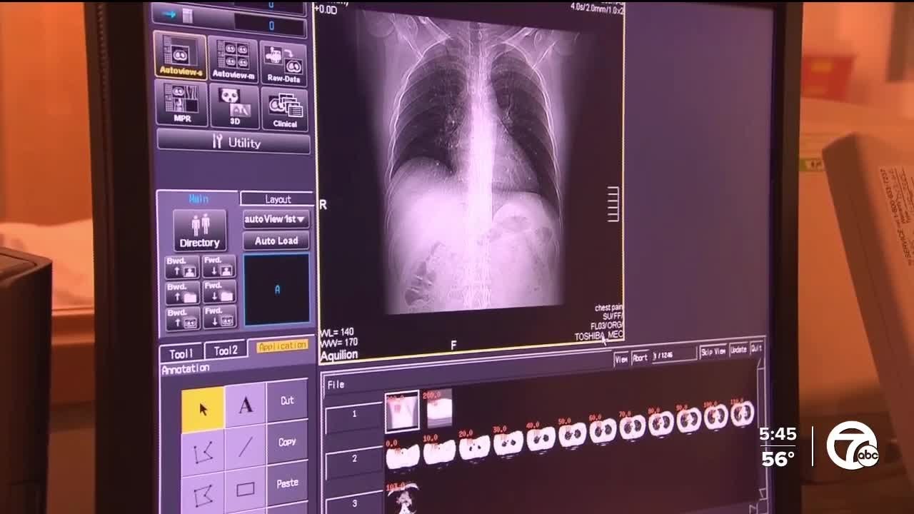 Lung cancer remains leading cause of cancer deaths, but survival rates rise