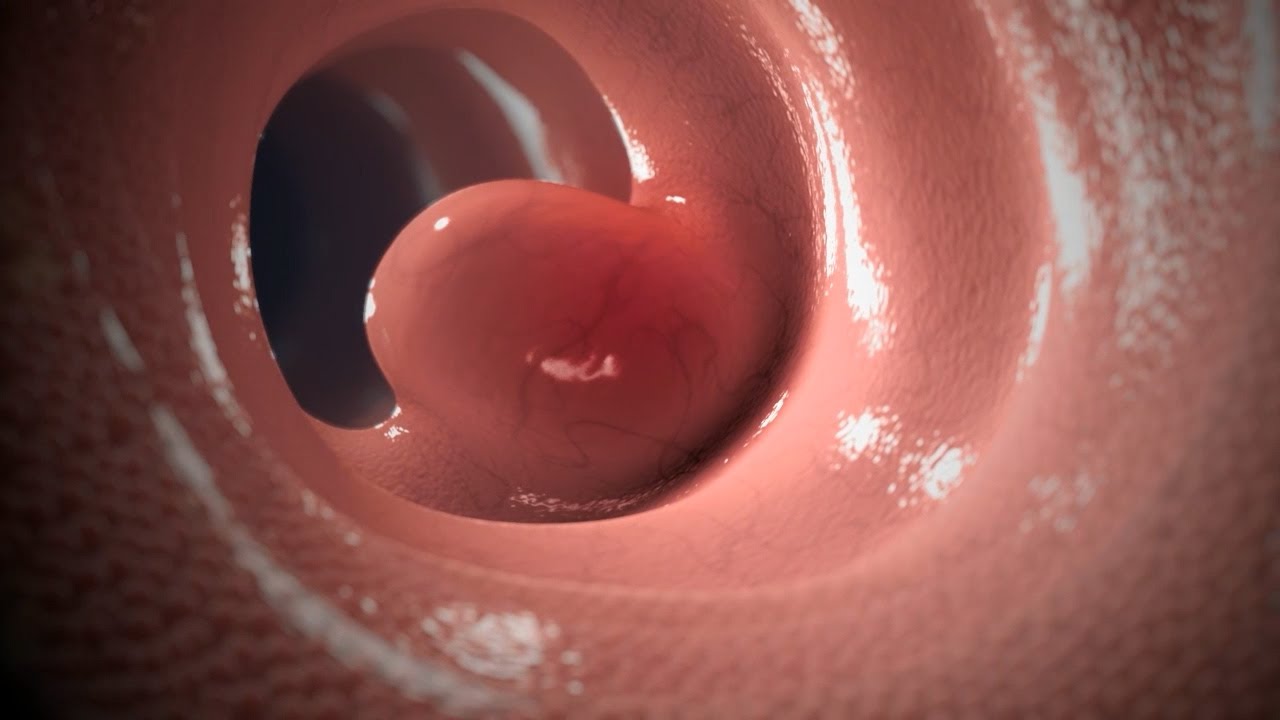 Гливек | Анимация MOA