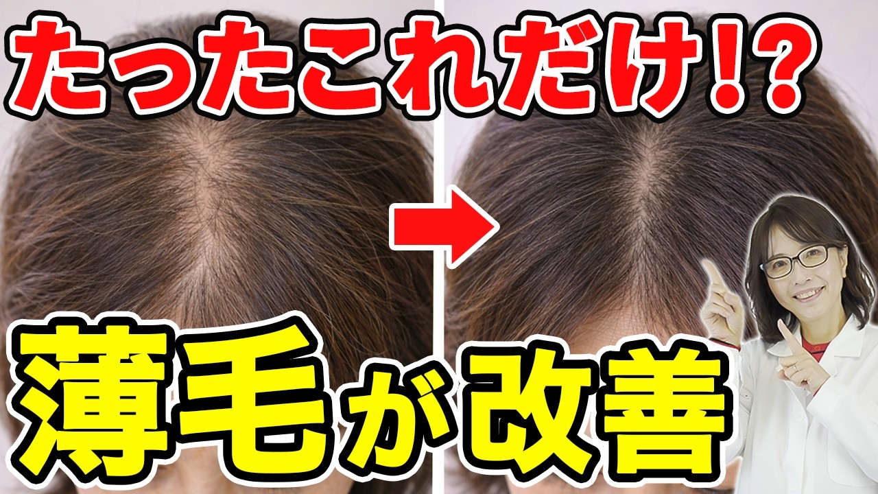 【更年期】抜け毛が増える本当の原因｜髪が薄くなる体のサイン