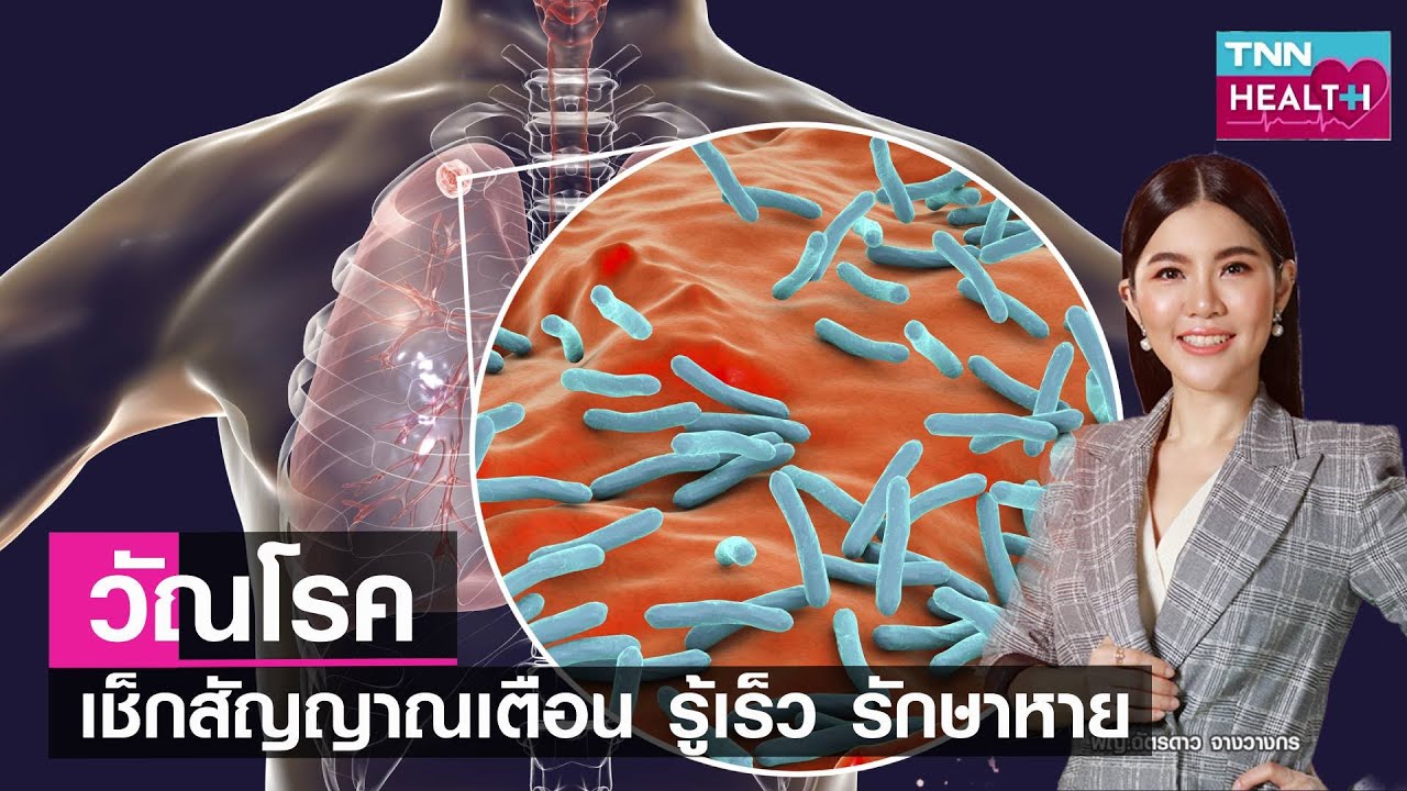 “วัณโรค” เช็กสัญญาณเตือน รู้เร็ว รักษาหาย l TNN HEALTH l 13 05 66