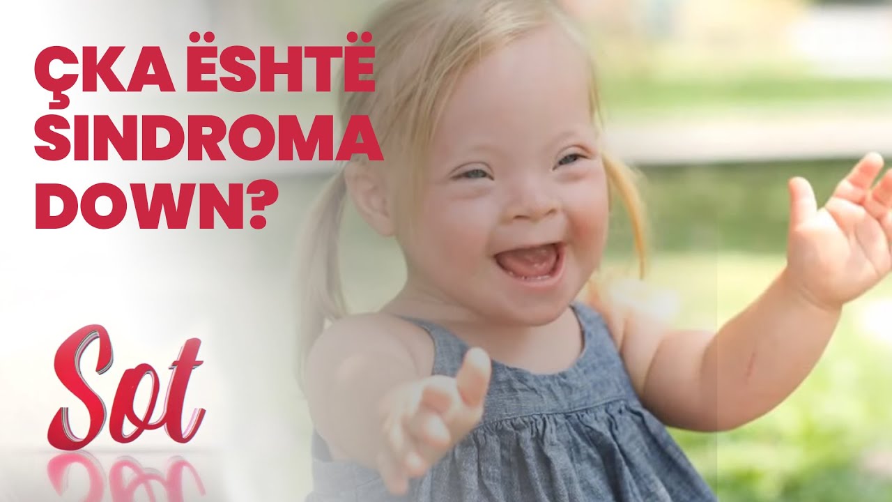 Çka është sindroma Down? - SOT, 20.03.2021