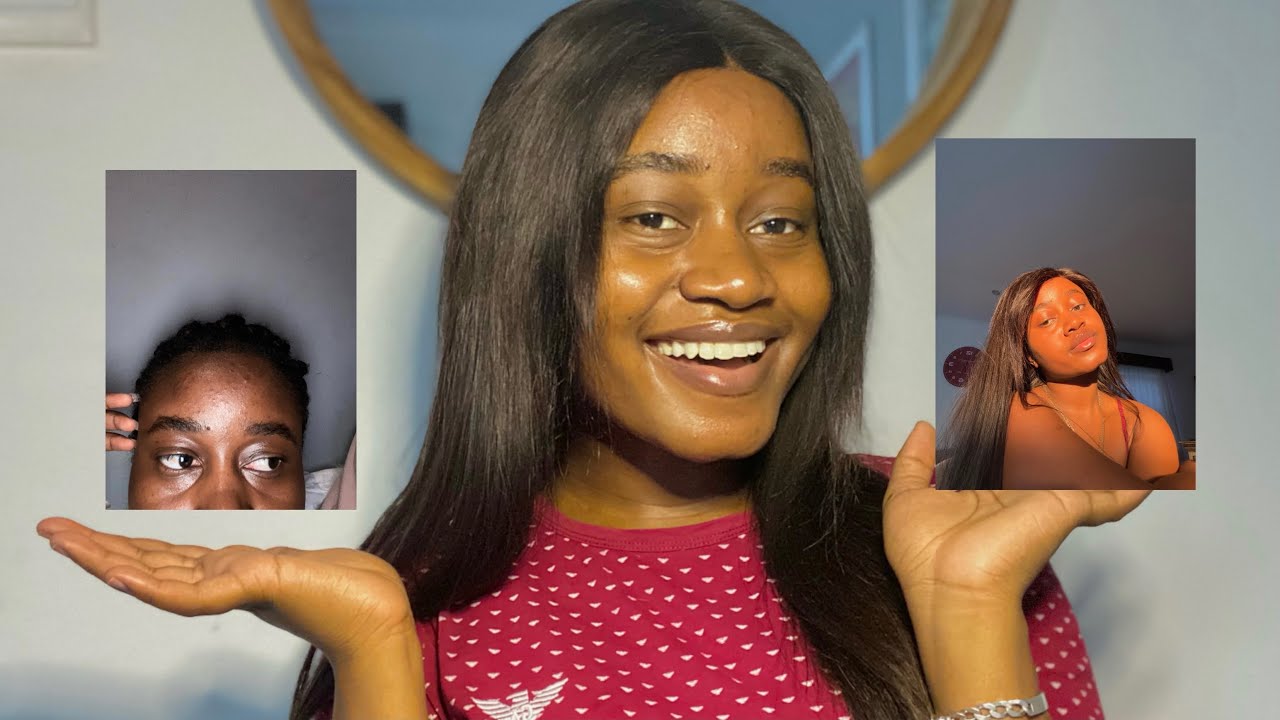 My Skin Care Routine With Acne Prone Skin | +PRIZE TO BE WON | Namibian Youtuber
