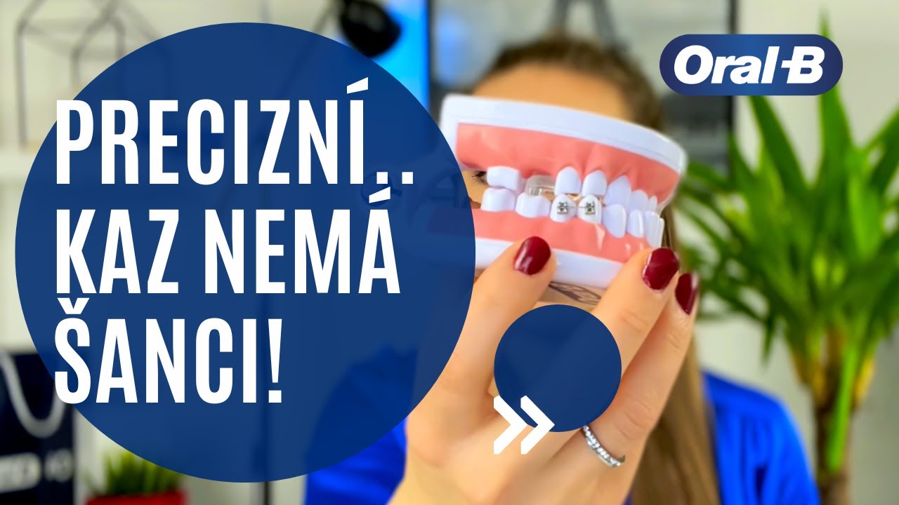 💡Elektrický kartáček + důležitost čištění zubů, hlavně pokud máte rovnátka. 🙏 2. video ze série