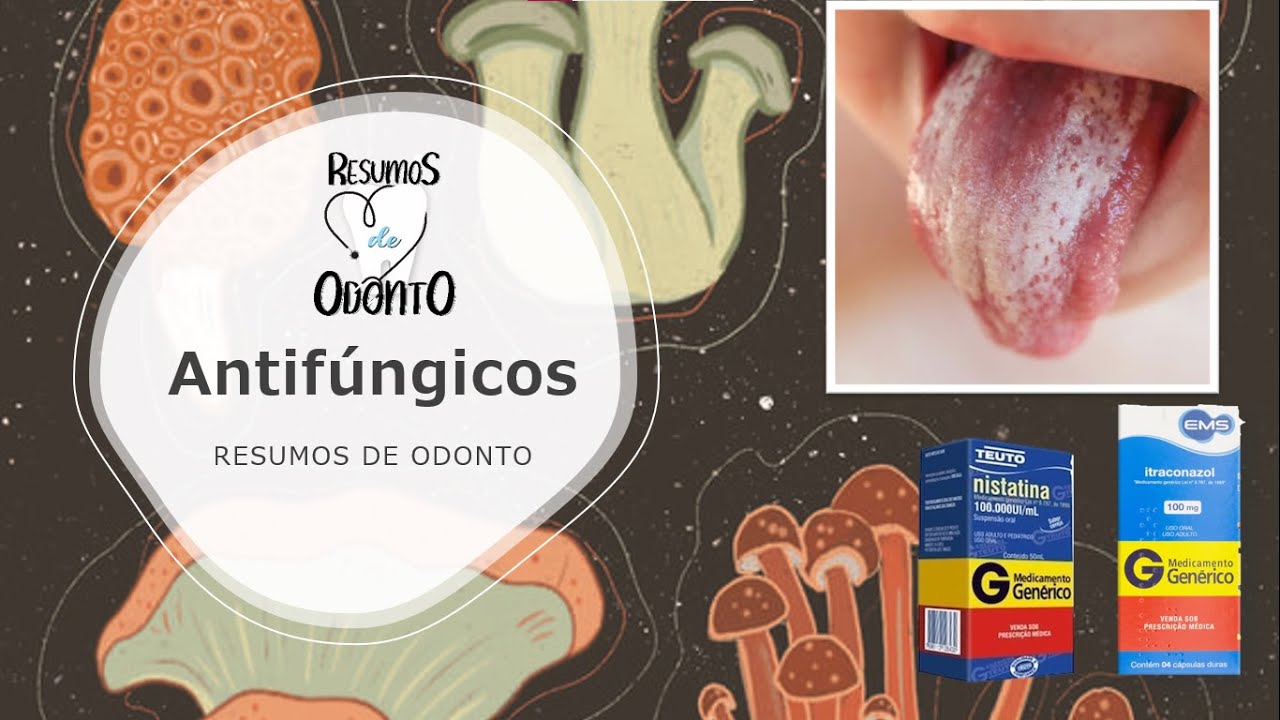 Antifúngicos na Boca | Resumos de Odonto