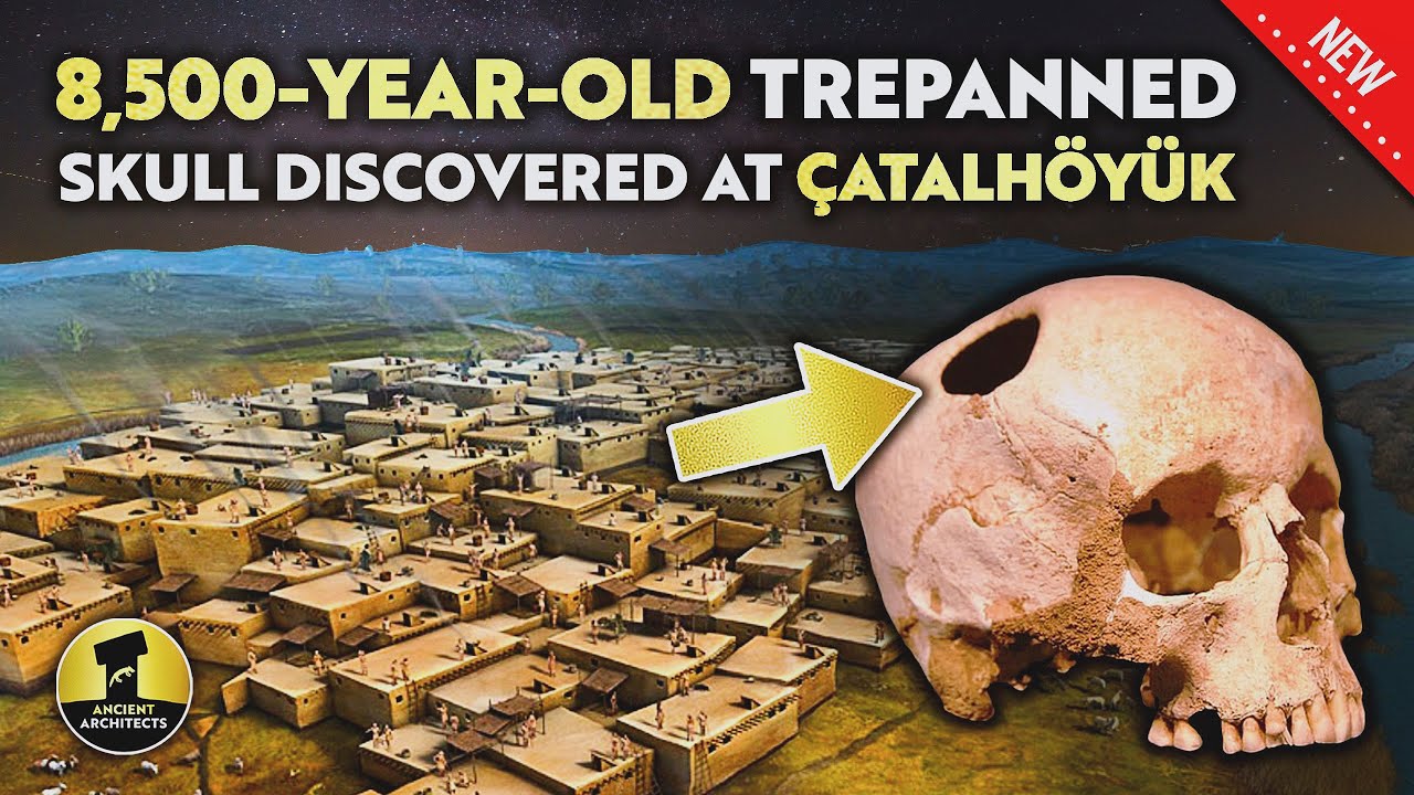 8,500-Year-Old Trepanned Human Skull Discovered at Çatalhöyük | Ancient Architects