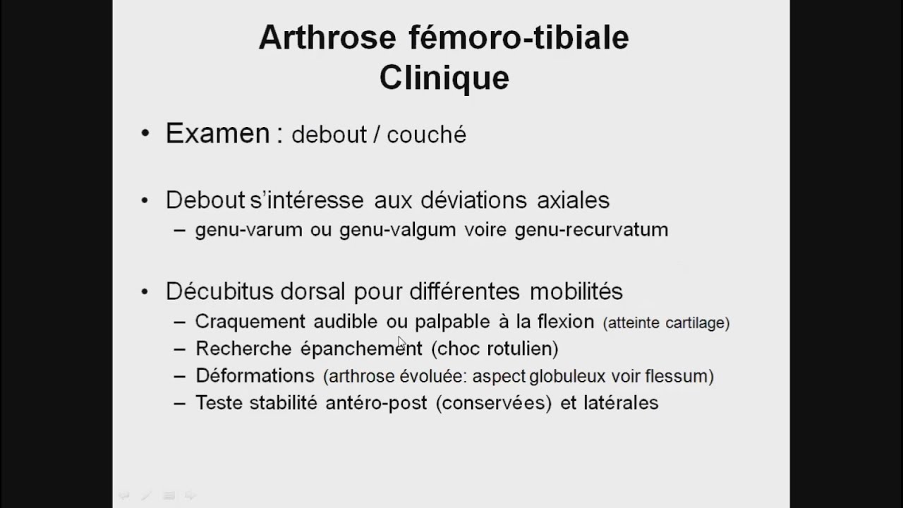 L' Arthrose: RHUMATOLOGIE