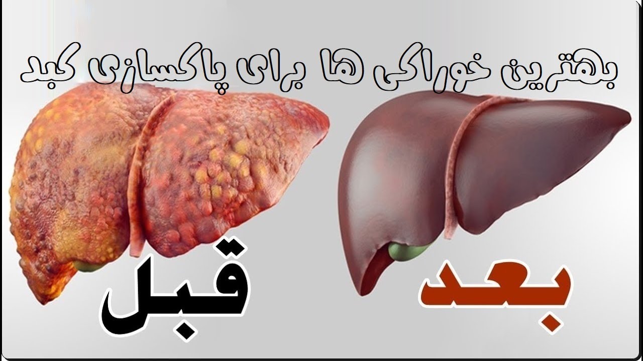بهترین خوراکی ها برای پاکسازی کبد