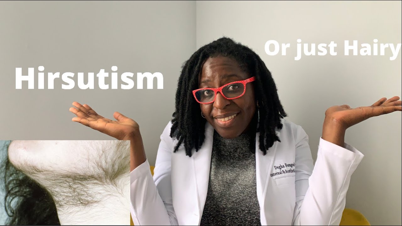 Doctor Explains: Hirsutism, PCOS and Facial Hair