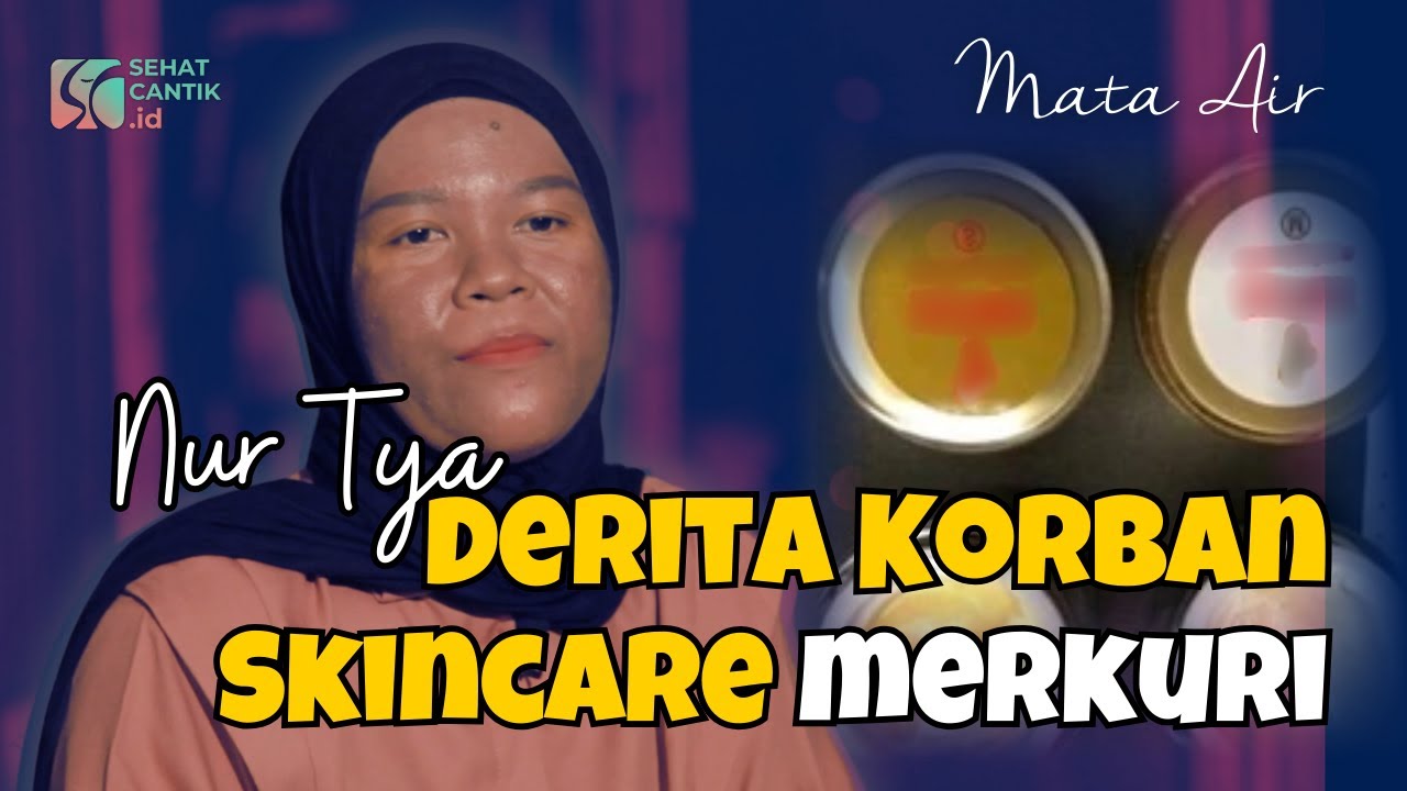 MATA AIR : NUR TYA, DERITA KORBAN SKINCARE MERKURI